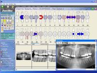 DentiMax Dental Software 08.01 screenshot. Click to enlarge!