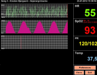 Patient Monitor 1.0.0.0 Alpha screenshot. Click to enlarge!